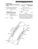 Cutting Balloon Catheter Having Increased Flexibility Regions diagram and image