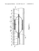 Cutting Balloon Catheter Having Increased Flexibility Regions diagram and image