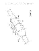 Cutting Balloon Catheter Having Increased Flexibility Regions diagram and image