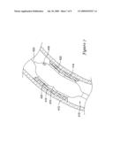 Cutting Balloon Catheter Having Increased Flexibility Regions diagram and image