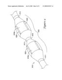 Cutting Balloon Catheter Having Increased Flexibility Regions diagram and image