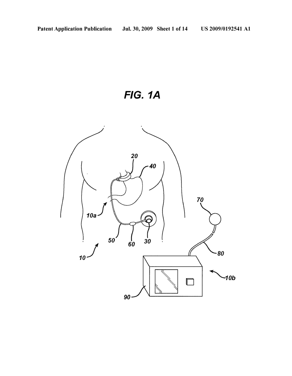 METHODS AND DEVICES FOR PREDICTING PERFORMANCE OF A GASTRIC RESTRICTION SYSTEM - diagram, schematic, and image 02