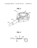 METHODS AND DEVICES FOR PREDICTING PERFORMANCE OF A GASTRIC RESTRICTION SYSTEM diagram and image