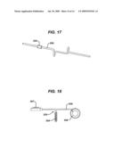 METHODS AND DEVICES FOR PREDICTING PERFORMANCE OF A GASTRIC RESTRICTION SYSTEM diagram and image