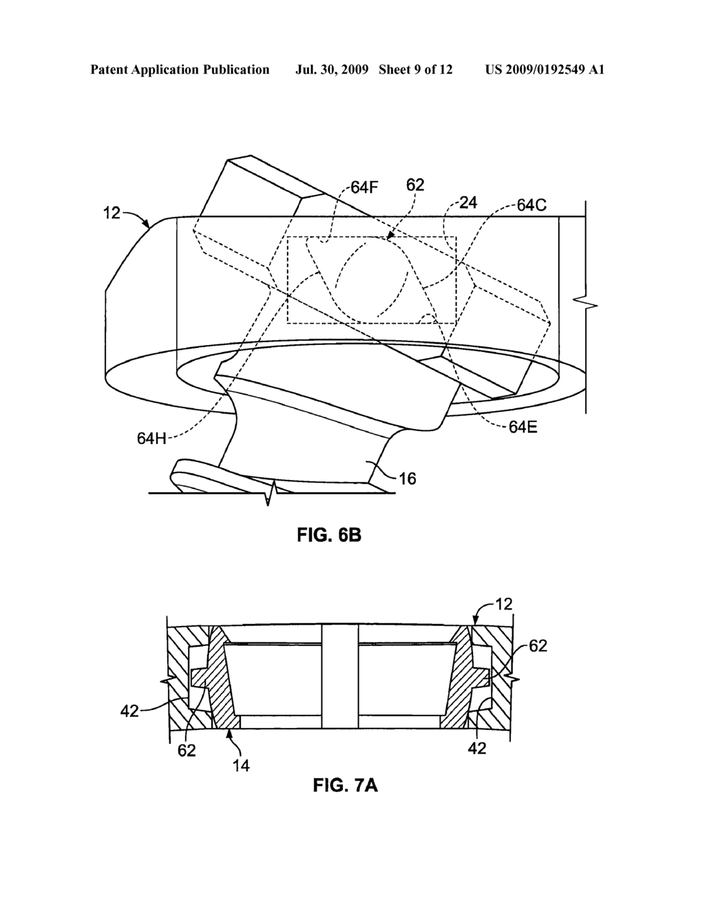 BONE PLATING SYSTEM - diagram, schematic, and image 10