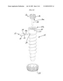 ANTI-BACKOUT MECHANISM diagram and image