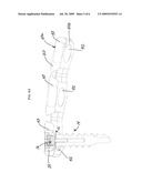 ANTI-BACKOUT MECHANISM diagram and image