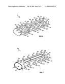 FIXATION OF IMPLANTABLE PULSE GENERATORS diagram and image