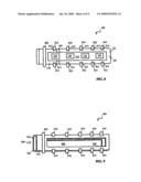 FIXATION OF IMPLANTABLE PULSE GENERATORS diagram and image