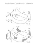 TWO-PIECE PROSTHETIC VALVES WITH SNAP-IN CONNECTION AND METHODS FOR USE diagram and image