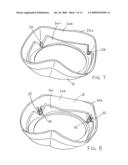 TWO-PIECE PROSTHETIC VALVES WITH SNAP-IN CONNECTION AND METHODS FOR USE diagram and image