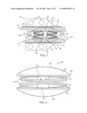 Intervertebral Prosthetic Disc With Shock Absorbing Core Formed With Disc Springs diagram and image