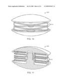 Intervertebral Prosthetic Disc With Shock Absorbing Core Formed With Disc Springs diagram and image