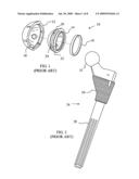 Constraining ring inserter diagram and image