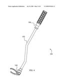 Constraining ring inserter diagram and image