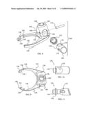 Constraining ring inserter diagram and image