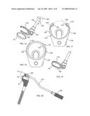 Constraining ring inserter diagram and image