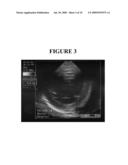 Echocardiographic Measurements As Predictors Of Racing Success diagram and image