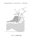 Clip Device and Laryngeal Mask Airway diagram and image