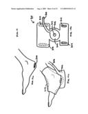 Apparatus for prevention and treatment of decubitus ulcers diagram and image