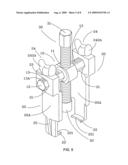 Forced puller diagram and image