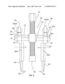 Forced puller diagram and image