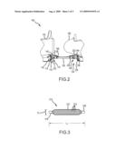 SAFETY RESTRAINT FOR VEHICLE TOWING ASSEMBLIES diagram and image