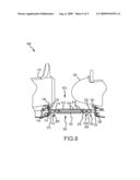 SAFETY RESTRAINT FOR VEHICLE TOWING ASSEMBLIES diagram and image