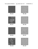 Anti-Alpha-V Immunoliposome Composition, Methods, and Uses diagram and image