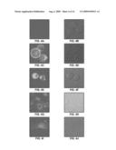 Anti-Alpha-V Immunoliposome Composition, Methods, and Uses diagram and image