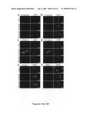 Methods of Diagnosing and Treating an Inflammatory Response diagram and image