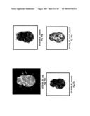 VINYL PHOSPHONATE LYSOPHOSPHATIDIC ACID RECEPTOR ANTAGONISTS diagram and image