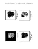 VINYL PHOSPHONATE LYSOPHOSPHATIDIC ACID RECEPTOR ANTAGONISTS diagram and image