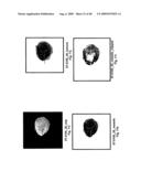 VINYL PHOSPHONATE LYSOPHOSPHATIDIC ACID RECEPTOR ANTAGONISTS diagram and image