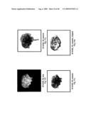 VINYL PHOSPHONATE LYSOPHOSPHATIDIC ACID RECEPTOR ANTAGONISTS diagram and image