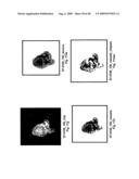 VINYL PHOSPHONATE LYSOPHOSPHATIDIC ACID RECEPTOR ANTAGONISTS diagram and image