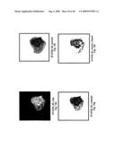 VINYL PHOSPHONATE LYSOPHOSPHATIDIC ACID RECEPTOR ANTAGONISTS diagram and image