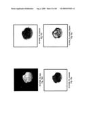 VINYL PHOSPHONATE LYSOPHOSPHATIDIC ACID RECEPTOR ANTAGONISTS diagram and image