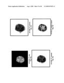 VINYL PHOSPHONATE LYSOPHOSPHATIDIC ACID RECEPTOR ANTAGONISTS diagram and image