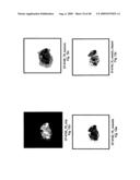 VINYL PHOSPHONATE LYSOPHOSPHATIDIC ACID RECEPTOR ANTAGONISTS diagram and image