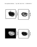 VINYL PHOSPHONATE LYSOPHOSPHATIDIC ACID RECEPTOR ANTAGONISTS diagram and image