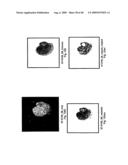 VINYL PHOSPHONATE LYSOPHOSPHATIDIC ACID RECEPTOR ANTAGONISTS diagram and image