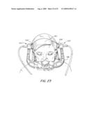 Ultrasonic Method And Apparatus For Measuring Intracranial Contents Volume Change diagram and image