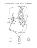 BLANKING INFECTION MONITORING DURING RECHARGE diagram and image