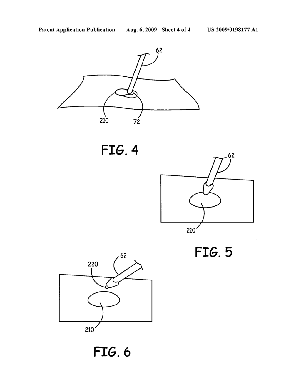 Surgical delivery system for medical sealant - diagram, schematic, and image 05