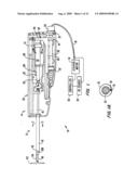 Tissue Separating Catheter Assembly and Method diagram and image