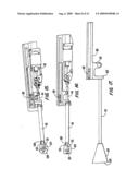 Tissue Separating Catheter Assembly and Method diagram and image