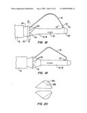 Tissue Separating Catheter Assembly and Method diagram and image