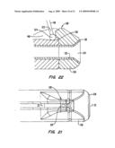 Tissue Separating Catheter Assembly and Method diagram and image