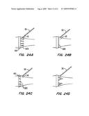 Tissue Separating Catheter Assembly and Method diagram and image